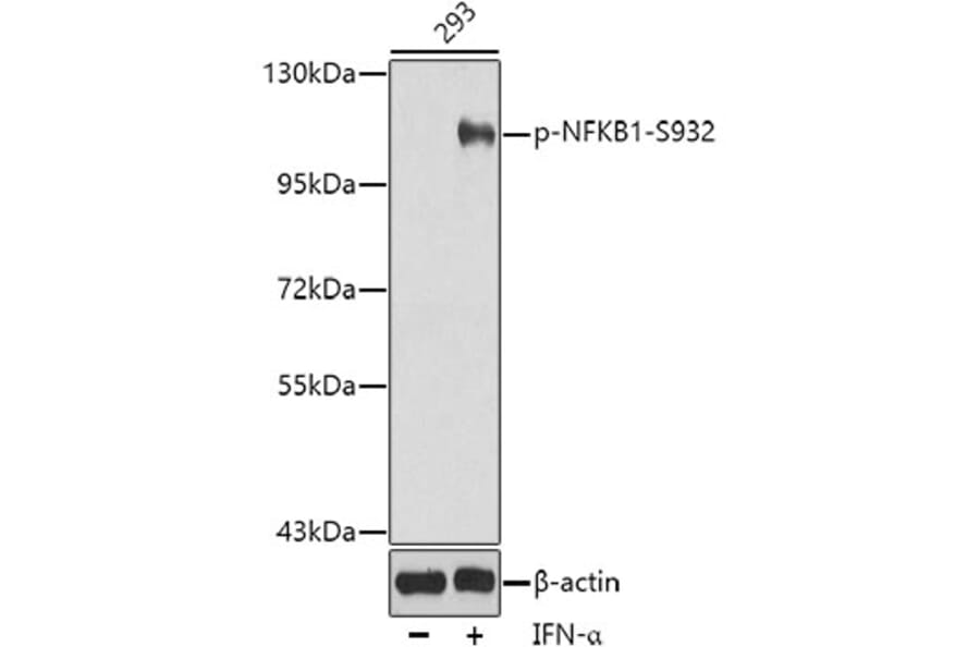 Western Blot - Anti-NFkB p105/p50 (phospho Ser932) Antibody (A16639) - Antibodies.com