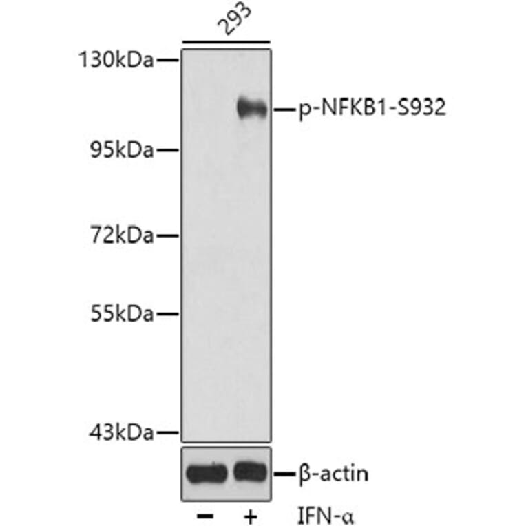 Western Blot - Anti-NFkB p105 / p50 (phospho Ser932) Antibody (A16639) - Antibodies.com