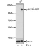 Western Blot - Anti-NFkB p105 / p50 (phospho Ser932) Antibody (A16639) - Antibodies.com