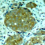 Immunohistochemistry - Anti-NFkB p105 / p50 (phospho Ser932) Antibody (A16639) - Antibodies.com