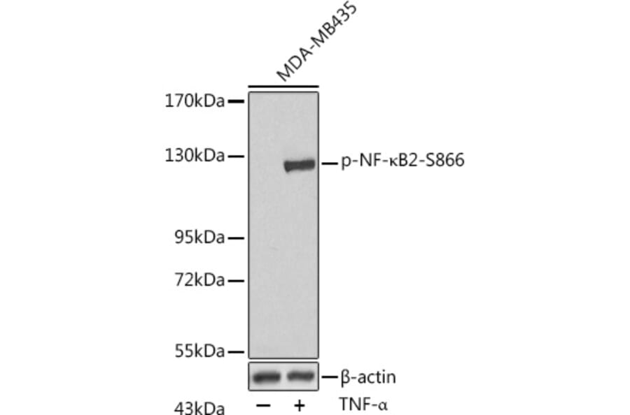 Western Blot - Anti-NFkB p100/NFKB2 (phospho Ser866) Antibody (A16640) - Antibodies.com