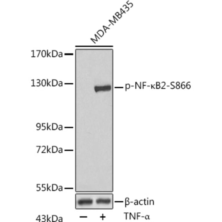 Western Blot - Anti-NFkB p100/NFKB2 (phospho Ser866) Antibody (A16640) - Antibodies.com