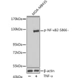 Western Blot - Anti-NFkB p100/NFKB2 (phospho Ser866) Antibody (A16640) - Antibodies.com