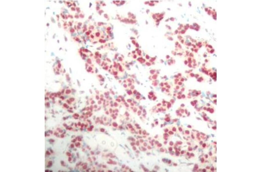 Immunohistochemistry - Anti-NFkB p100/NFKB2 (phospho Ser866) Antibody (A16640) - Antibodies.com