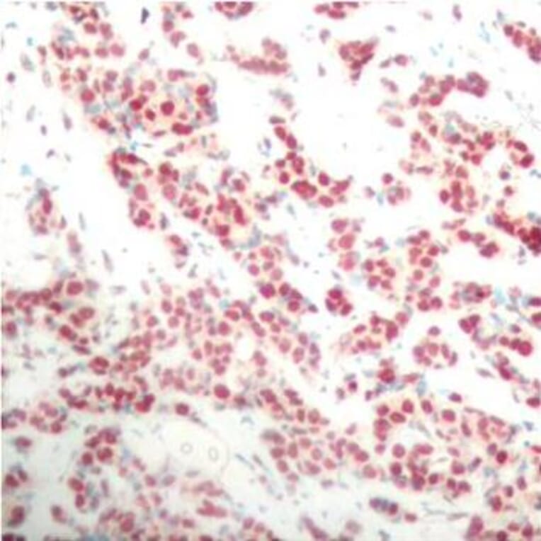 Immunohistochemistry - Anti-NFkB p100/NFKB2 (phospho Ser866) Antibody (A16640) - Antibodies.com