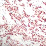 Immunohistochemistry - Anti-NFkB p100/NFKB2 (phospho Ser866) Antibody (A16640) - Antibodies.com