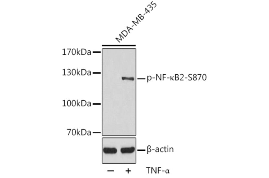 Western Blot - Anti-NFkB p100 / NFKB2 (phospho Ser870) Antibody (A16641) - Antibodies.com