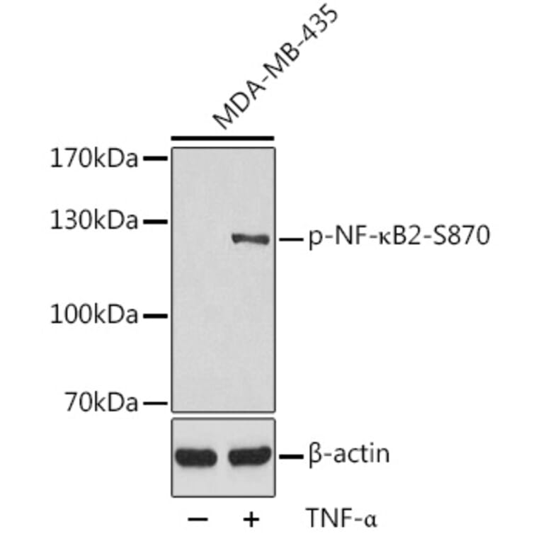 Western Blot - Anti-NFkB p100 / NFKB2 (phospho Ser870) Antibody (A16641) - Antibodies.com