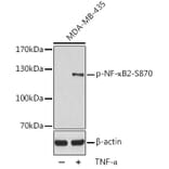Western Blot - Anti-NFkB p100 / NFKB2 (phospho Ser870) Antibody (A16641) - Antibodies.com