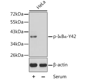 Western Blot - Anti-IKB alpha (phospho Tyr42) Antibody (A16642) - Antibodies.com