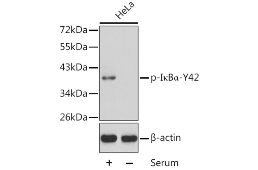 Western Blot - Anti-IKB alpha (phospho Tyr42) Antibody (A16642) - Antibodies.com