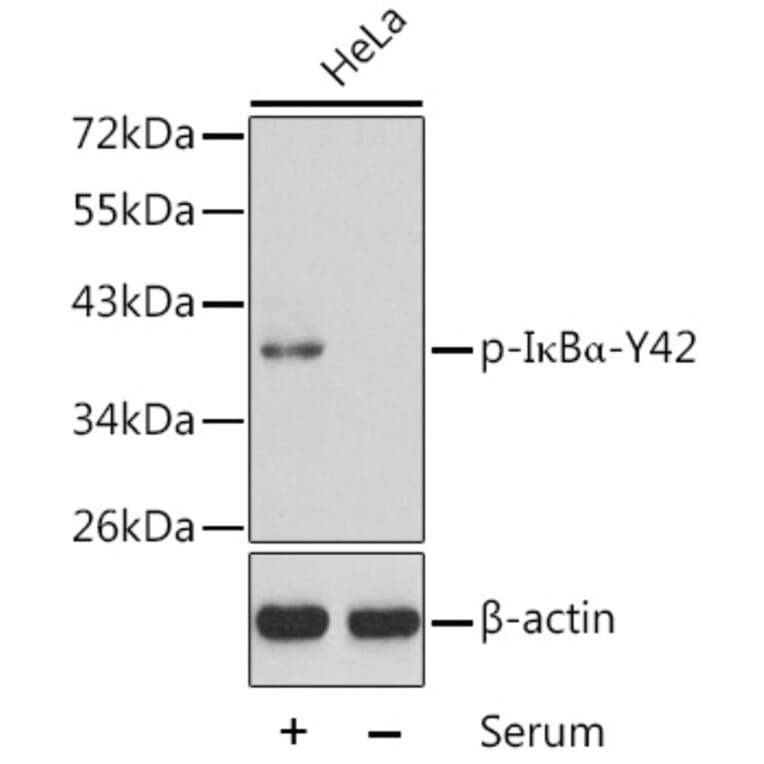 Western Blot - Anti-IKB alpha (phospho Tyr42) Antibody (A16642) - Antibodies.com