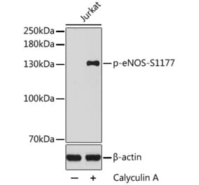 Western Blot - Anti-eNOS (phospho Ser1177) Antibody (A16643) - Antibodies.com