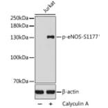 Western Blot - Anti-eNOS (phospho Ser1177) Antibody (A16643) - Antibodies.com