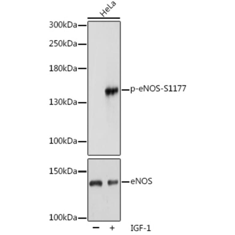 Western Blot - Anti-eNOS (phospho Ser1177) Antibody (A16643) - Antibodies.com