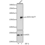 Western Blot - Anti-eNOS (phospho Ser1177) Antibody (A16643) - Antibodies.com