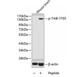 Western Blot - Anti-TrkB (phospho Tyr705) Antibody (A16645) - Antibodies.com