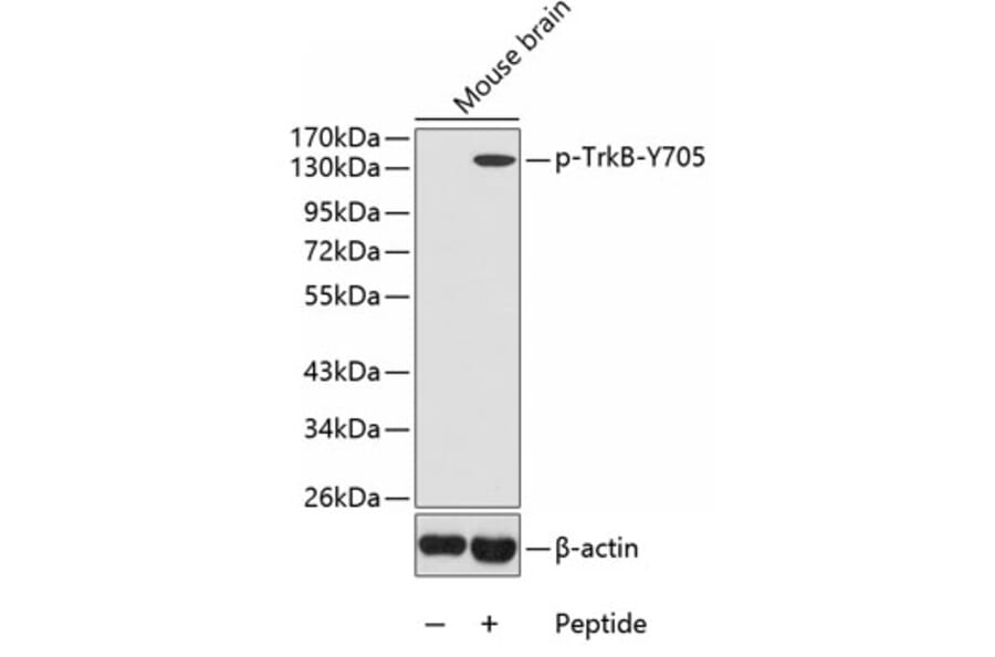 Western Blot - Anti-TrkB (phospho Tyr705) Antibody (A16645) - Antibodies.com