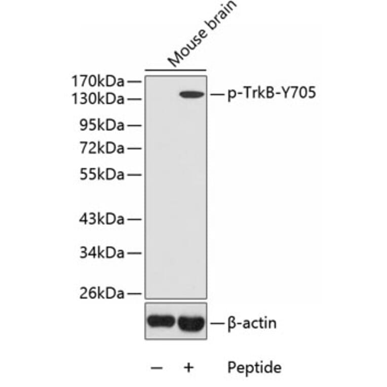 Western Blot - Anti-TrkB (phospho Tyr705) Antibody (A16645) - Antibodies.com