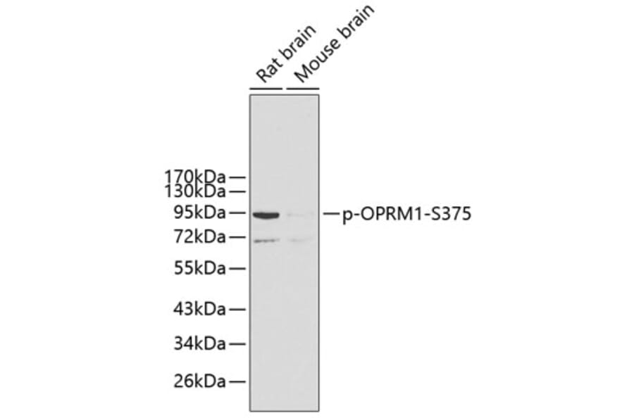 Western Blot - Anti-OPRM1 (phospho S375) Antibody (AP0424) - Antibodies.com