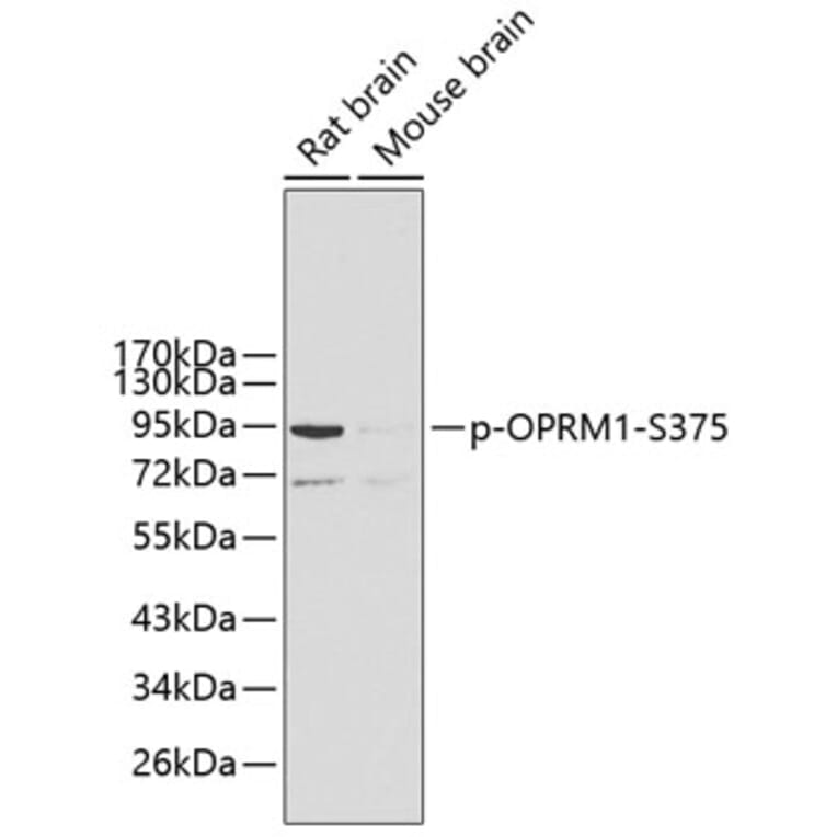 Western Blot - Anti-OPRM1 (phospho S375) Antibody (AP0424) - Antibodies.com