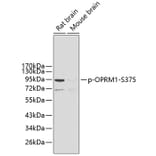 Western Blot - Anti-OPRM1 (phospho S375) Antibody (AP0424) - Antibodies.com