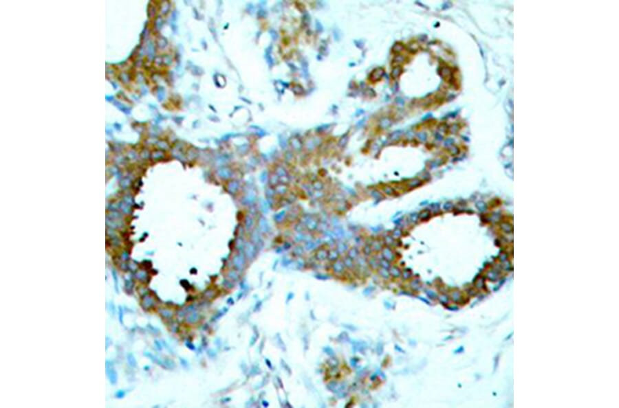 Immunohistochemistry - Anti-PAK1 (phospho T423) + PAK2 (phospho T402) + PAK3 (phospho T421) Antibody (AP0425) - Antibodies.com