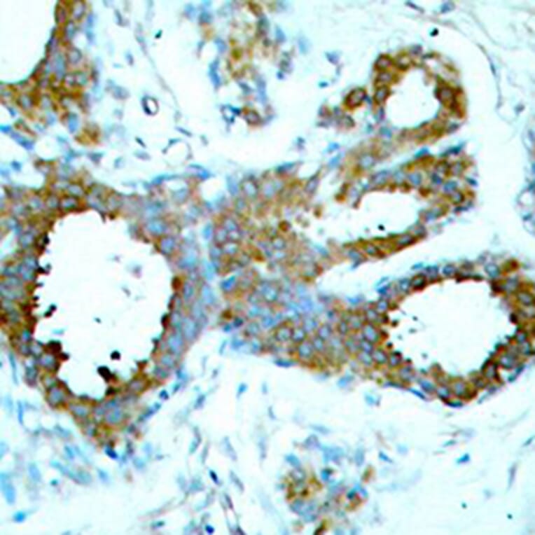 Immunohistochemistry - Anti-PAK1 (phospho T423) + PAK2 (phospho T402) + PAK3 (phospho T421) Antibody (AP0425) - Antibodies.com