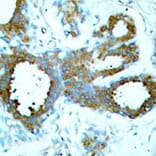 Immunohistochemistry - Anti-PAK1 (phospho T423) + PAK2 (phospho T402) + PAK3 (phospho T421) Antibody (AP0425) - Antibodies.com