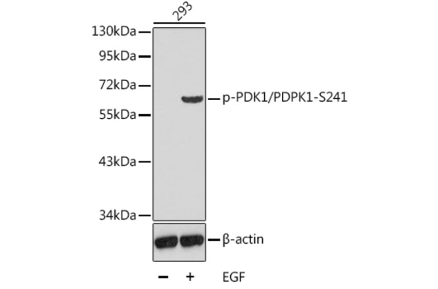 Western Blot - Anti-PDPK1 (phospho Ser241) Antibody (A16648) - Antibodies.com