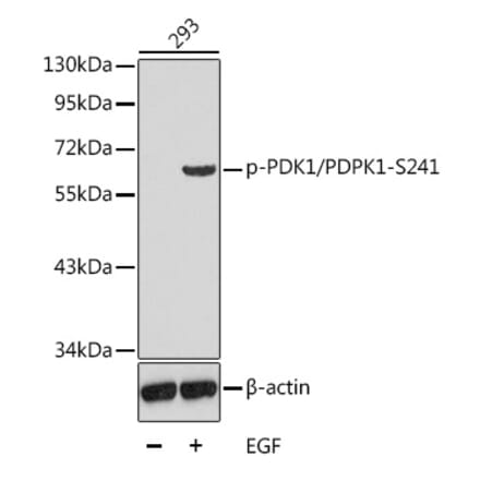 Western Blot - Anti-PDPK1 (phospho Ser241) Antibody (A16648) - Antibodies.com