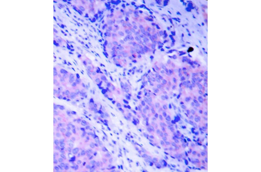 Immunohistochemistry - Anti-PDPK1 (phospho Ser241) Antibody (A16648) - Antibodies.com