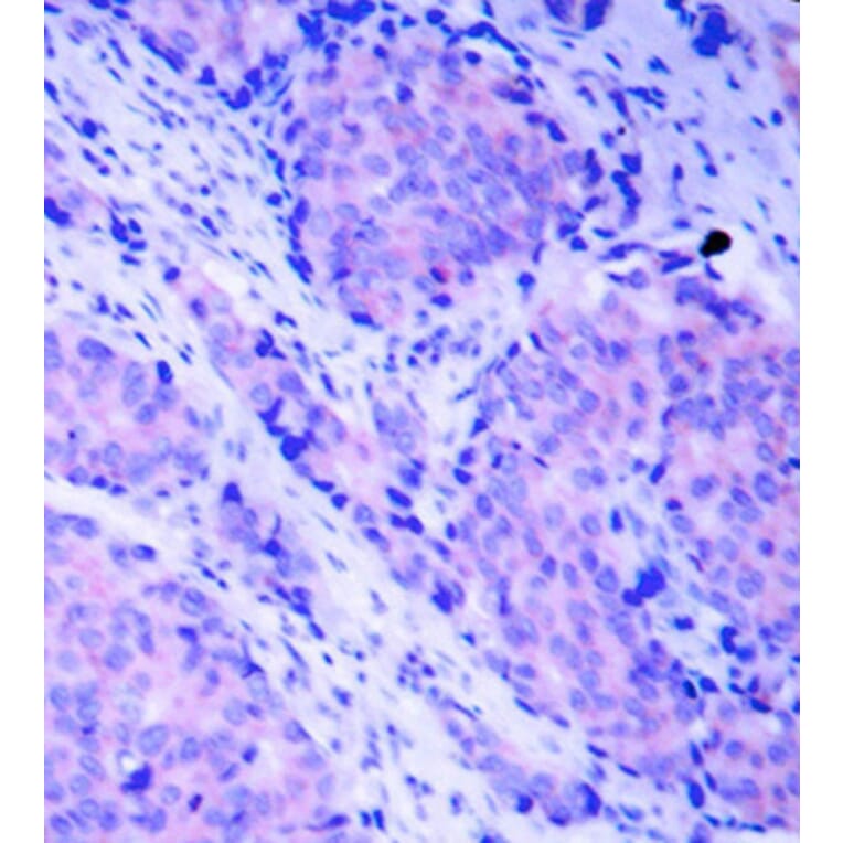 Immunohistochemistry - Anti-PDPK1 (phospho Ser241) Antibody (A16648) - Antibodies.com