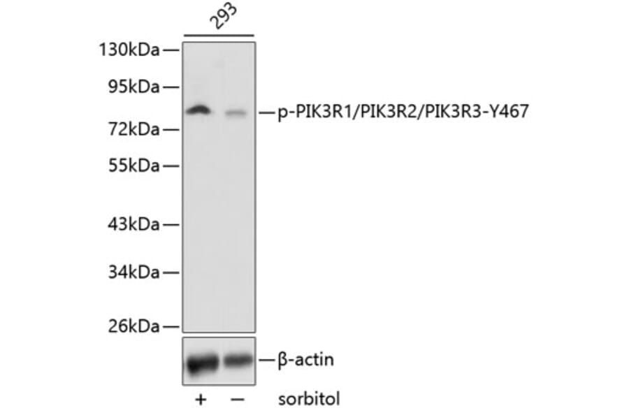 Western Blot - Anti-PI 3 Kinase p85 alpha + PI 3 Kinase p55 gamma + PI 3 Kinase p85 beta (phospho Tyr467 + Tyr464 + Tyr199) Antibody (A16649) - Antibodies.com