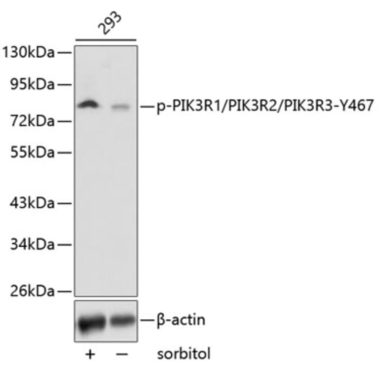 Western Blot - Anti-PI 3 Kinase p85 alpha + PI 3 Kinase p55 gamma + PI 3 Kinase p85 beta (phospho Tyr467 + Tyr464 + Tyr199) Antibody (A16649) - Antibodies.com