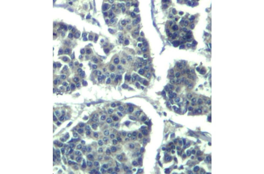 Immunohistochemistry - Anti-PLCG2 (phospho Y1217) Antibody (AP0429) - Antibodies.com