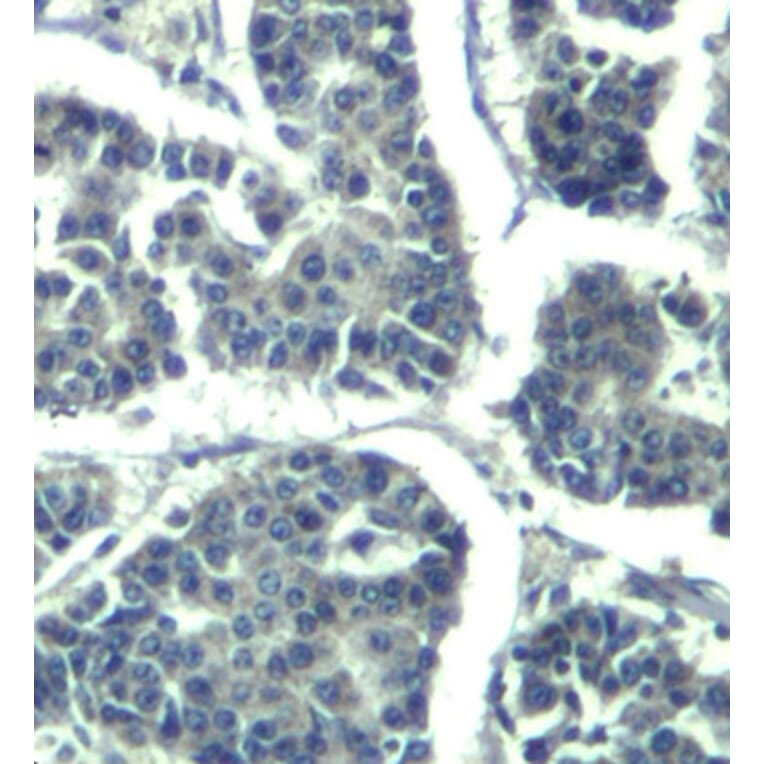 Immunohistochemistry - Anti-PLCG2 (phospho Y1217) Antibody (AP0429) - Antibodies.com