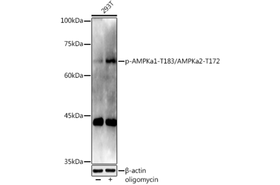 Western Blot - Anti-AMPK alpha 1 (phospho Thr183) + AMPK alpha 2 (phospho Thr172) Antibody (A16652) - Antibodies.com