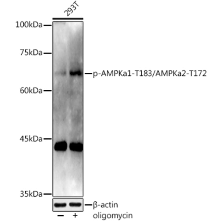 Western Blot - Anti-AMPK alpha 1 (phospho Thr183) + AMPK alpha 2 (phospho Thr172) Antibody (A16652) - Antibodies.com