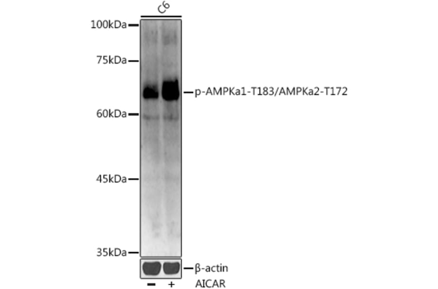 Western Blot - Anti-AMPK alpha 1 (phospho Thr183) + AMPK alpha 2 (phospho Thr172) Antibody (A16652) - Antibodies.com