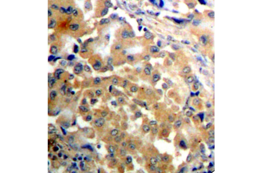 Immunohistochemistry - Anti-PRKCZ (phospho T410) Antibody (AP0433) - Antibodies.com