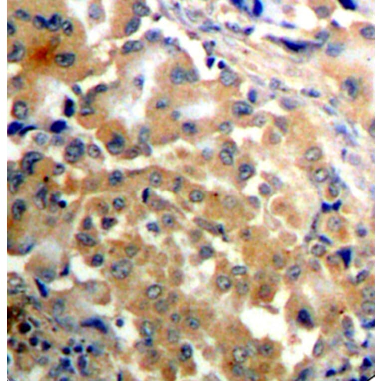 Immunohistochemistry - Anti-PRKCZ (phospho T410) Antibody (AP0433) - Antibodies.com