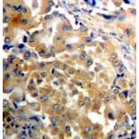 Immunohistochemistry - Anti-PRKCZ (phospho T410) Antibody (AP0433) - Antibodies.com