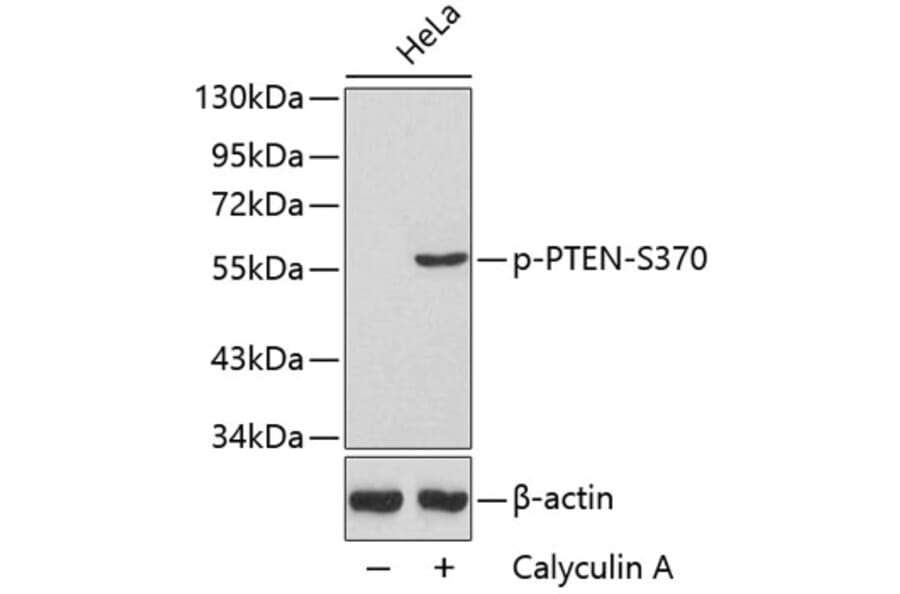 Western Blot - Anti-PTEN (phospho S370) Antibody (AP0435) - Antibodies.com