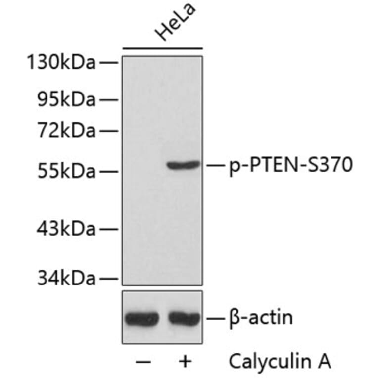 Western Blot - Anti-PTEN (phospho S370) Antibody (AP0435) - Antibodies.com