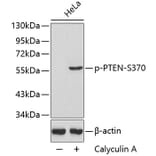 Western Blot - Anti-PTEN (phospho S370) Antibody (AP0435) - Antibodies.com