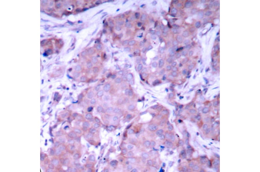 Immunohistochemistry - Anti-PTEN (phospho S380) Antibody (AP0436) - Antibodies.com