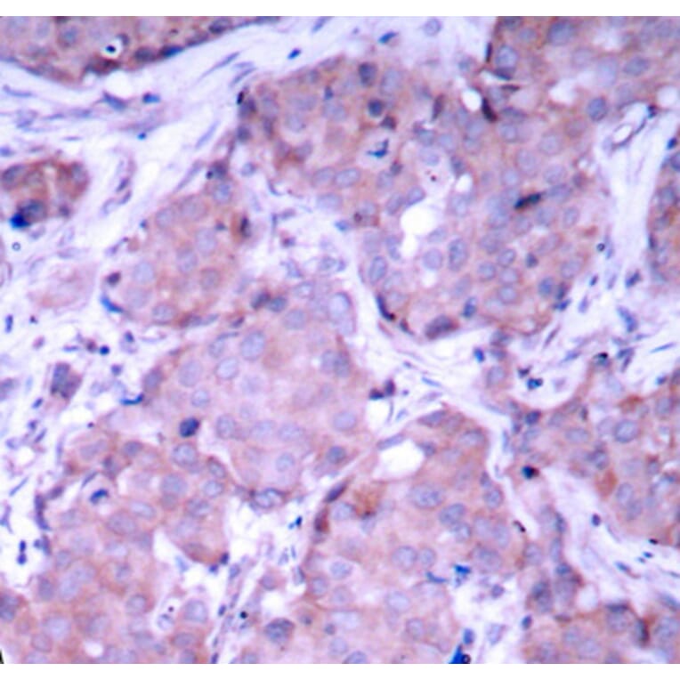 Immunohistochemistry - Anti-PTEN (phospho S380) Antibody (AP0436) - Antibodies.com