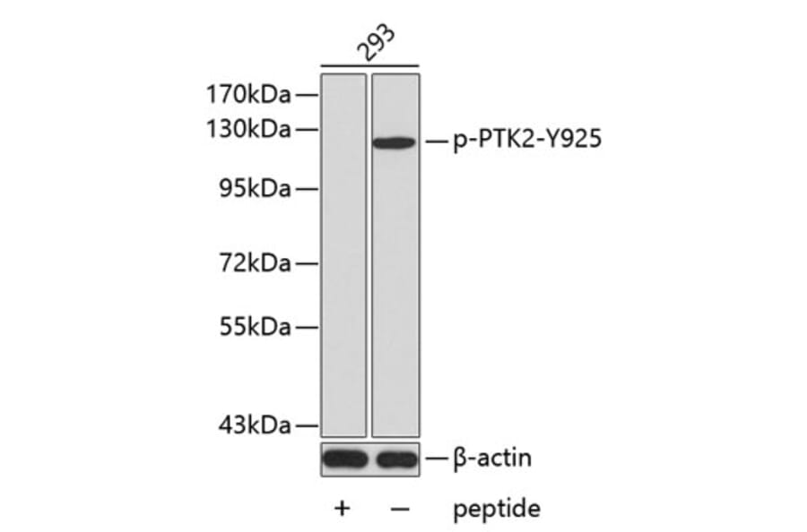 Western Blot - Anti-PTK2 (phospho Y925) Antibody (AP0438) - Antibodies.com