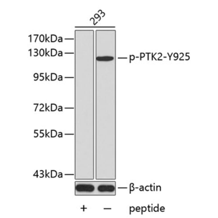 Western Blot - Anti-PTK2 (phospho Y925) Antibody (AP0438) - Antibodies.com